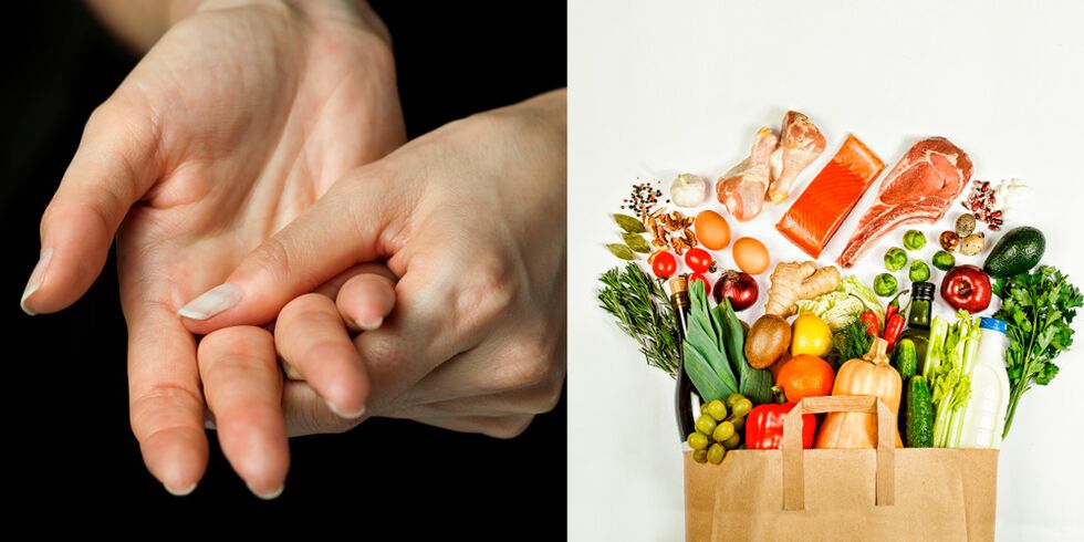 arthrite goutteuse des mains et aliments pour son traitement